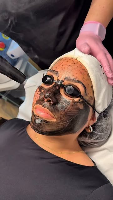 Paciente con mascarilla de carbón y gafas de protección durante una limpieza facial en cabina